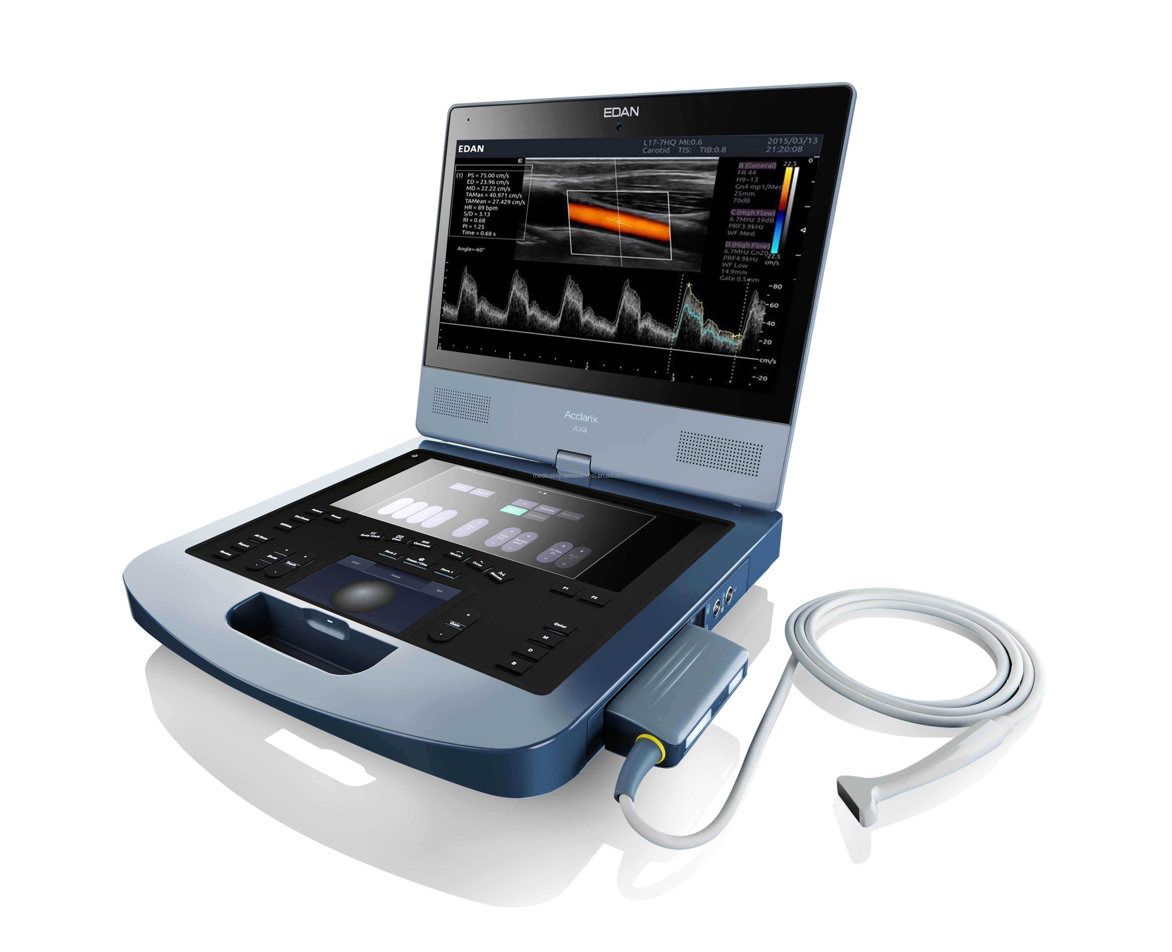 Edan AX4 Laptop 3D/4D Color Doppler Ultrasound scanner