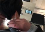 Wireless Digital Microscope Dermatoscope Skin And Hair Scanner For Android And