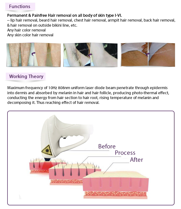 Professional Commercial Laser Hair Removal Machine Vertical 13*13mm2 / 13*39mm2