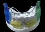 Frankel 2/3 Orthodontic Appliance, enhancing Jaw Alignment in Growing Children