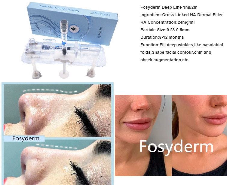 Transparent HA Injectable Volume Hyaluronic Dermal Filler For Face With Syringe