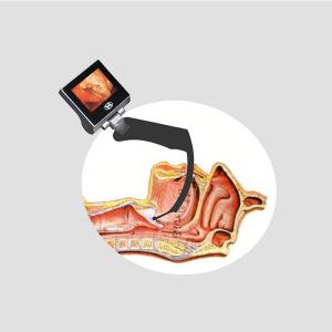 Wholesale ICU NICU CCU Anti Fog Lens Adult Laryngoscope For Neonates from china suppliers