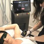 4 Wavelengths Diode Ice Laser Machine Vertical Hair Removal Picosecond Nd Yag