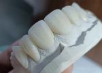 Strength Wear Resistant Ceramic crown Bridge for Comfortable Precise Dental