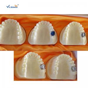 China Producing Steps Of Marilan Bridge Dental Study Models For Teeth Teaching on sale