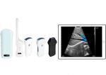 305mm Wifi Portable Ultrasound Bladder Scanner Convex+Linear+Cardiac Probe