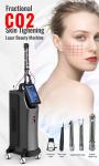 Fractional Co2 Laser Skin Resurfacing Carbon Dioxide Laser Tube Machine