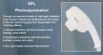 Multifunction Black Gold DPL IPL NIR Skin Whitening Spot Removal Hair Removal