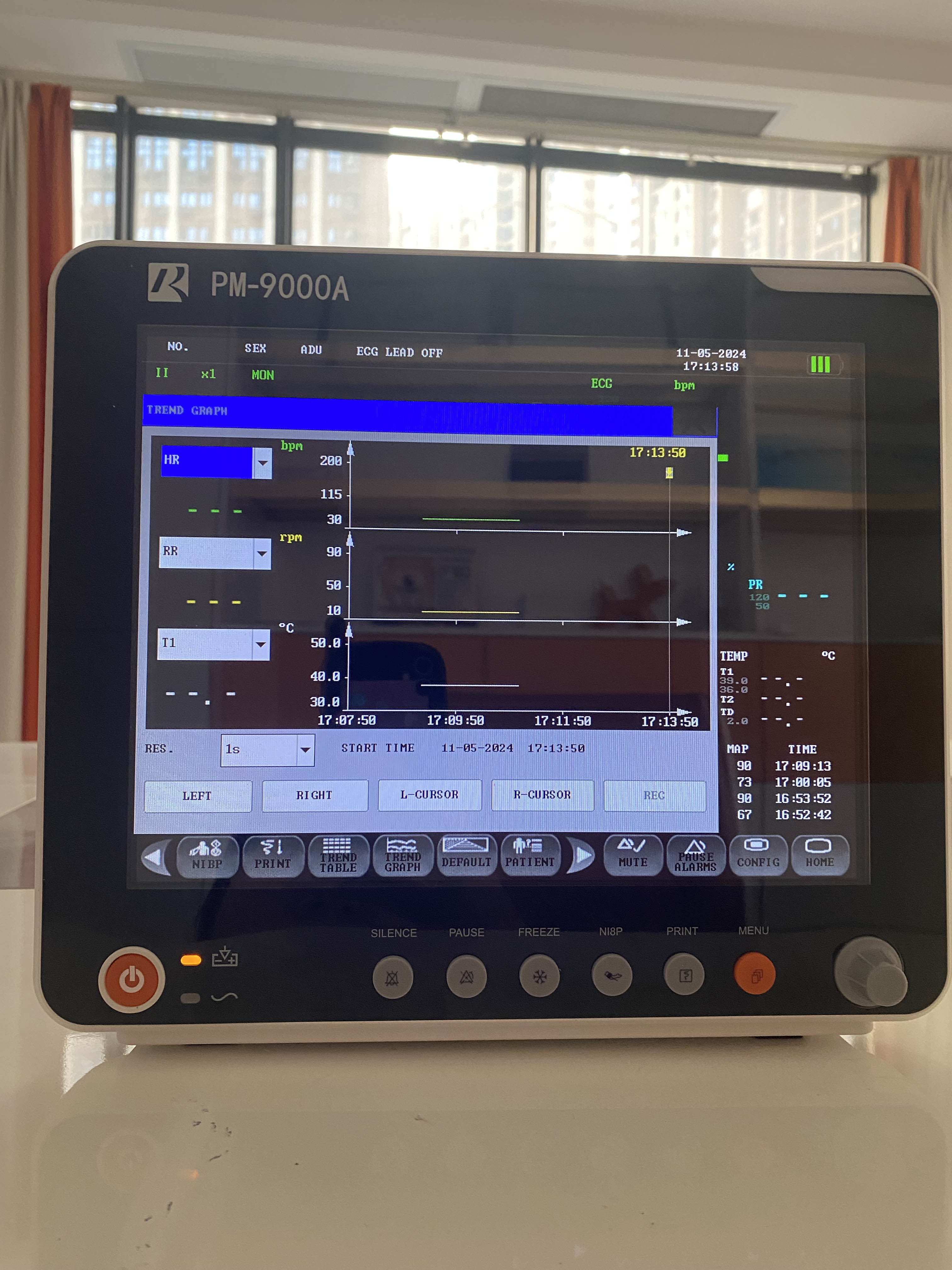 Multi-Parameter Nursing Bedside Monitoring Hospital Operation Room Patient Monitor