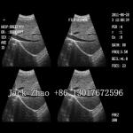 Portable Black and white Ultrasound Scanner