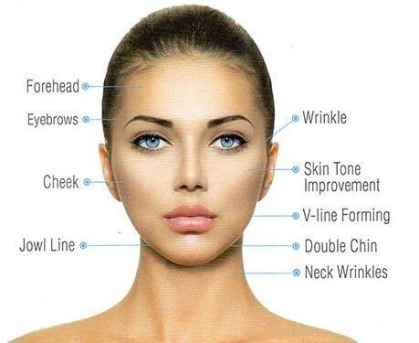 2016 USA focused ultrasound HIFU machine/HIFU Face lift/ made in China