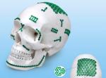 Multiholes Plates Maxillofacial Implant Y Shaped titanium bone implants
