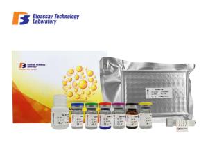 Wholesale Sandwich Immunosorbent Human ELISA Kit ASB2 96 Well Plate 3.04ng/L Sensitivity from china suppliers