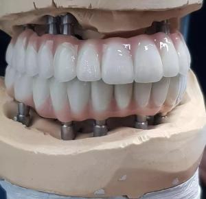 Wholesale Precision-Crafted Zirconia Implant Screw Cement Retained for Natural-Looking Teeth from china suppliers