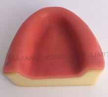 China implant training jaw model(with soft gum) on sale