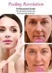 30ml Skin Peeling Serum / Professional Grade Liquid Set for Face Skin Exfoliatio