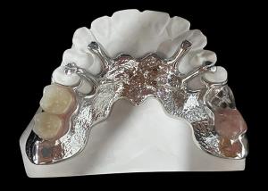 Wholesale Customizable Cast Partial Removable Denture With Acrylic Resin / Metal Base Design from china suppliers
