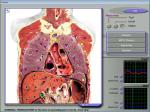 3d Nls Health Body Composition Analyzer , Blood Cell Analyzer
