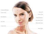 7D 8D Ultrasound Hifu Beauty Machine Anti Wrinkle Face Lifting