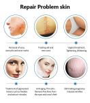 Surgical Fractional Co2 Laser Yag Laser Carbon Acne Scar Removal Wrinkle