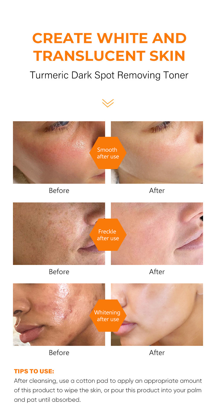 Private Label Face Toner Moisturizing Spray Deep Face Hydrating Quickly Absorb VC Whitening Skin Moisturizing Face Spray