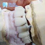 Implant Operation Cases / Implant Procedure Cases for Diverse Implant Choices