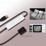 Digital X-ray System, Dental X-ray Sensor