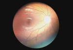 Ophthalmic Device Digital Fundus Camera Opthalmoscope With Diopter of -20~+20D