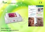 Smart RBS System High Frequency 30MHZ Spider Vein Removal Machine for Clinic /