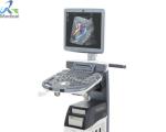Medical Ultrasound Spare Parts GE Voluson S6 S8 6324556-2 CPU SOM BT16