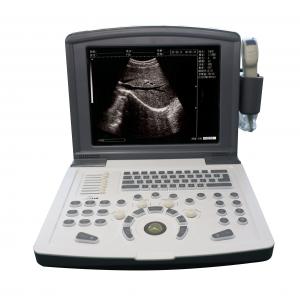 China Portable Full Digital Diagnostic Ultrasound scanner OEM on sale