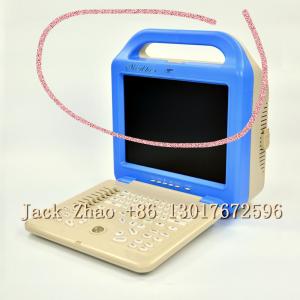 Wholesale Medbes Human Portable Ultrasound Machine Hospital Equipment Machine from china suppliers