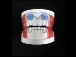 Fixed Appliance Dental Functional Appliance Good Fixation Adequate Anchorage