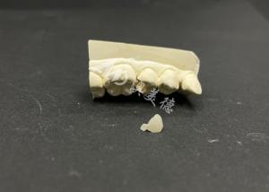 Wholesale Hypoallergenic Stain-Resistant Emax Ceramic Inlay for Accurate Repair of Damaged Teeth from china suppliers