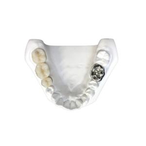 Wholesale The Color Of The Porcelain Crown Is Stablenot And Has Strong Stability from china suppliers