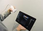 5MHz USB Palm Probe Connected Ipad Color Ultrasound