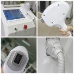 diode laser hair removal