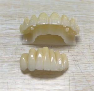 Wholesale Precision Zirconia Multilayer Product For Improving Fracture Resistance from china suppliers