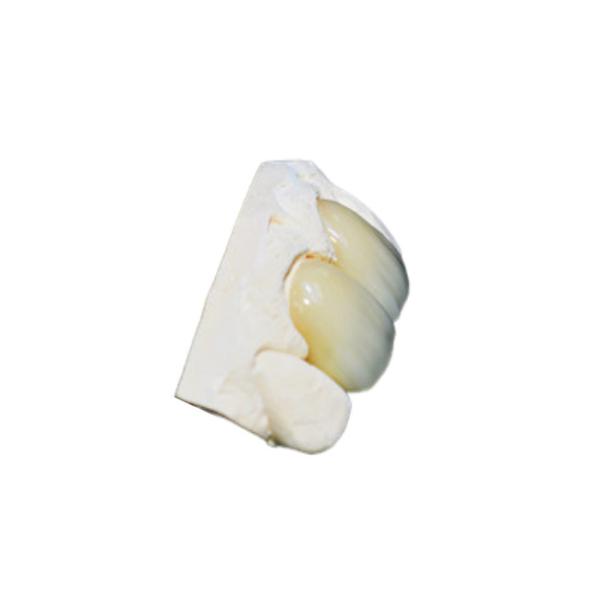 Computer-Aided Manufactured Zirconia Dental Crowns with Natural Tooth Color &