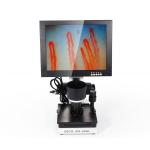 Portable 10 Inch LED Display Nail Fold Capillaroscopy Microcirculation Test