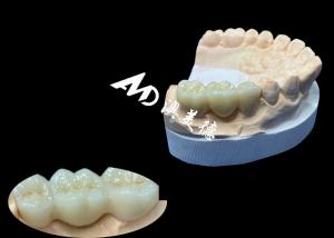 Wholesale Natural Color Zirconia Dental Crown Crack Resistant For A Flawless Smile from China Dental Lab from china suppliers