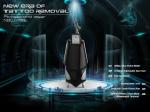 Tattoo Removal Picosecond Laser Device 1064nm/ 755nm/ 532nm Picosecond Laser