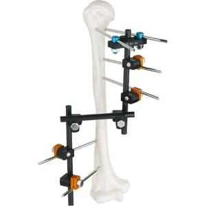 Wholesale Condylar External Fixation Device from china suppliers
