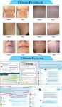 Germany imported filter smart beauty instrument 808 diode laser hair removal