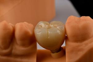 Wholesale Oral Implantology Self Tapping Single Tooth Dental Implants With Internal Hex Connection from china suppliers