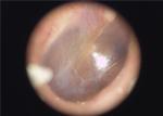 Disposable Earmuff Available Medical Portable Otoscope Endoscope For Ear Eye