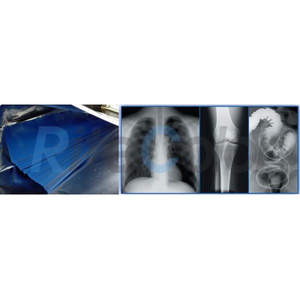 Blue Medical Imaging Film X - ray , Hospital Blue Sensitive Film 280gsm