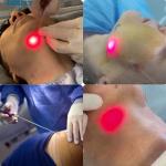 980nm 1470nm Endolaser Face Lifting Laser Machine 8 Inches Touch Screen Diode